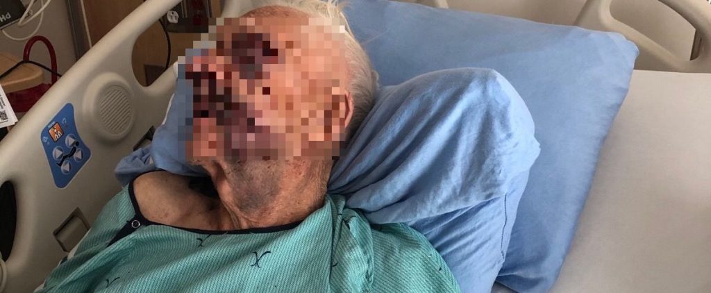 BC Man Attacked By Machete