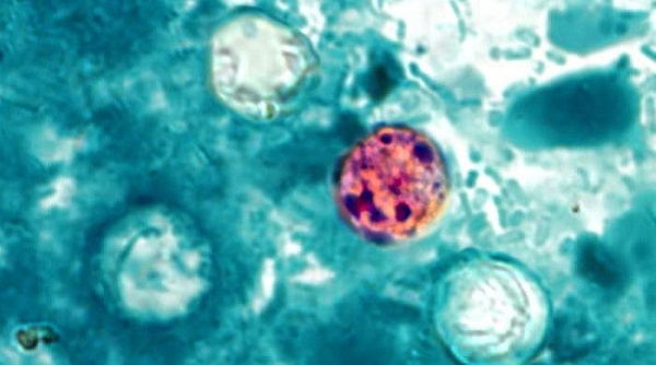 Cyclosporiasis canada